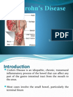 Crohn's Disease