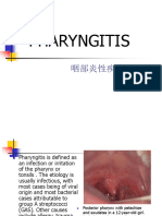 Pharyngitis