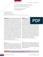 Caso Clinico de Molluscum Contagiosum