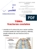 Fracturas Costales