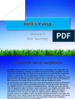 Bell's Palsy