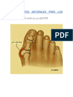 Tratamientos Naturales para Los Juanetes