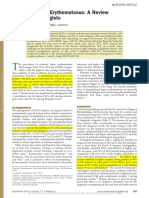 Systemic Lupus Erythematosus