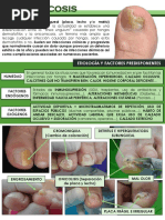 Onicomicosis (Tinea Unguium) PDF