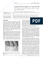 Tinea Pedis and Tinea Unguium in A 7-Year-Old Child: Case Report