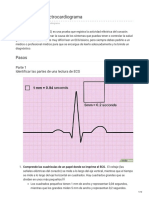 Como Interpretar Un ECG