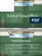 Retinal Detachment