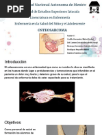 Osteosarcoma