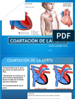 Coartacion de La Aorta