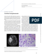 Cerebral Toxoplasmosis: Clinicalpicture