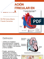 Comunicación Interventricular en Pediatría