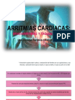 Arritmias Cardiacas