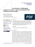 Acute Mesenteric Ischemia: A Challenging Diagnostic Disease-Four Cases Reports and Literature Review (AMI)