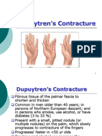 2 Dupuytrens Contracture