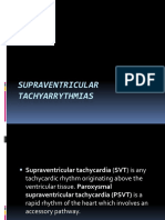 Supraventricular Tachyarrythmias