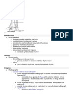 Ankle Fractures