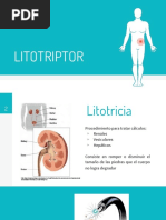 Litotriptor