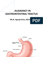 Malignancy in GI Tract-DR Agung