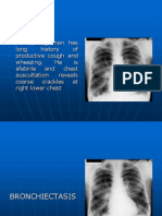 This Young Man Has Long History of Productive Cough and Wheezing. He Is Afebrile and Chest Auscultation Reveals Coarse Crackles at Right Lower Chest