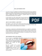 Caries de Cemento