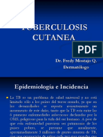 Tuberculosis Cutanea