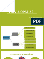 VALVULOPATIAS Med. Interna