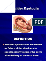 Shoulder Dystocia