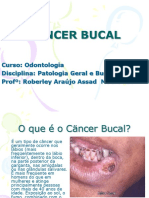 CÄNCER BUCAL-1.ppsx