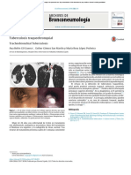 Tuberculosis Traqueobronquial