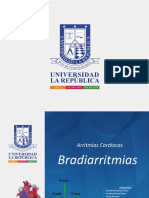 Bradiarritmias