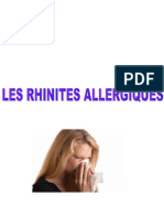 Ortho Rninites Allergiques-1