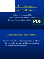 Cardiac Arrhythmias II: Tachyarrhythmias