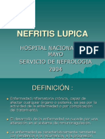 Nefritis Lúpica