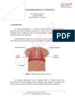 Hernia Diafragmática PDF