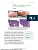 Abrupt Onset of Dysphagia, Arthritis, Joint Contractures, and Sheets of Monomorphous Waxy Papules