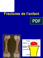 3 - Fractures de L'enfant