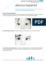 Pseudo Strabismus Explained