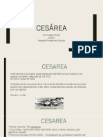 Cesarea Tecnica