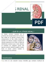 Litiasis Renal