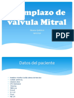 Reemplazo de Válvula Mitral