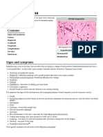 Cardiac Myxoma