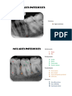 Dentoalveolares