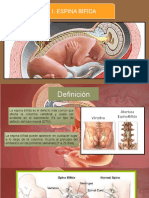 Defectos Cierre Tubo Neural