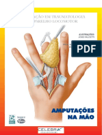 AMPUTAÇÕES Da Mão PDF