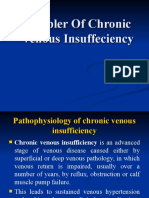 Doppler of Varicose Veins