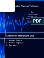 Herniated Nucleus Pulposus: By: Baron Ablang Giselle Cruz Denise Dela Cruz Ronnel Mactal