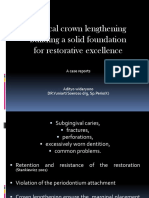 Surgical Crown Lengthening