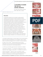 Reporte de Caso de Mordida Cruzada Posterior - Descripción de Un Protocolo de Tratamiento Efectivo