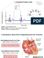 ECG: Standard Limb Leads: R-R: Heart Rate P-Q (R) : AV Conduction Time T-Q: Ventricular Diastole Q-T: Ventricular Systole