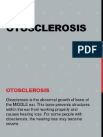 Otosclerosis